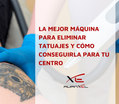 La mejor máquina para eliminar tatuajes y cómo conseguirla para tu centro