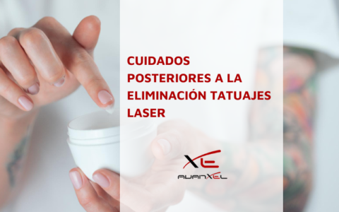 Cuidados posteriores a la eliminación tatuajes laser